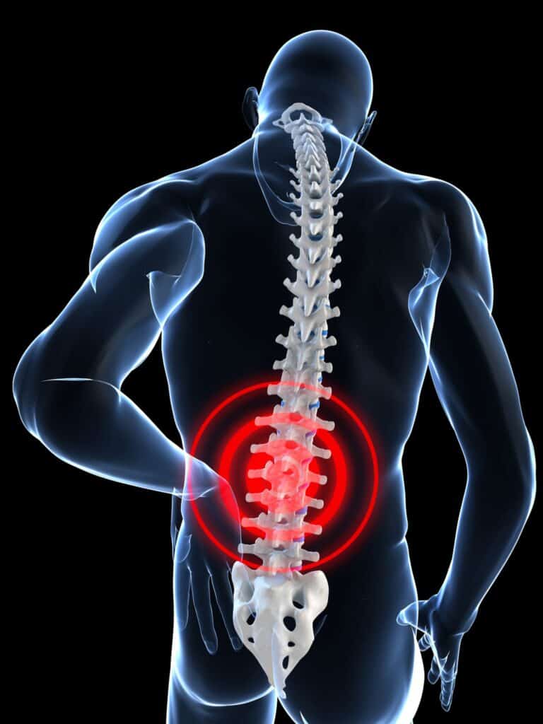 Image of Region of Low Back Pain