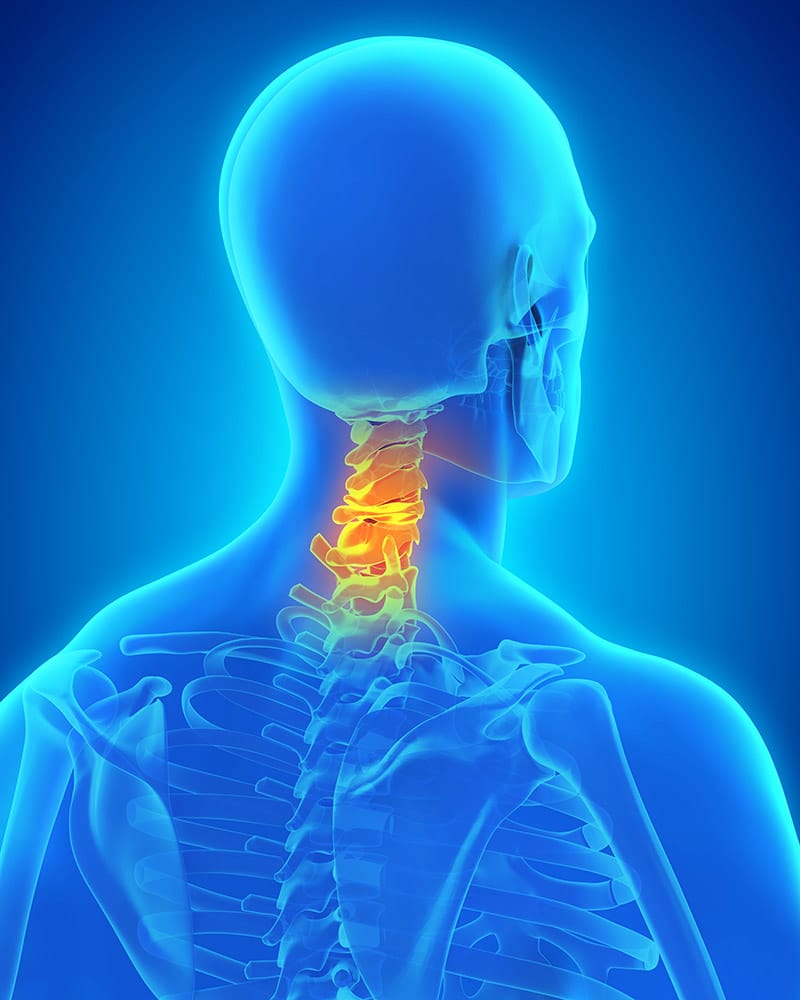 Cervical Spine - Neck pain